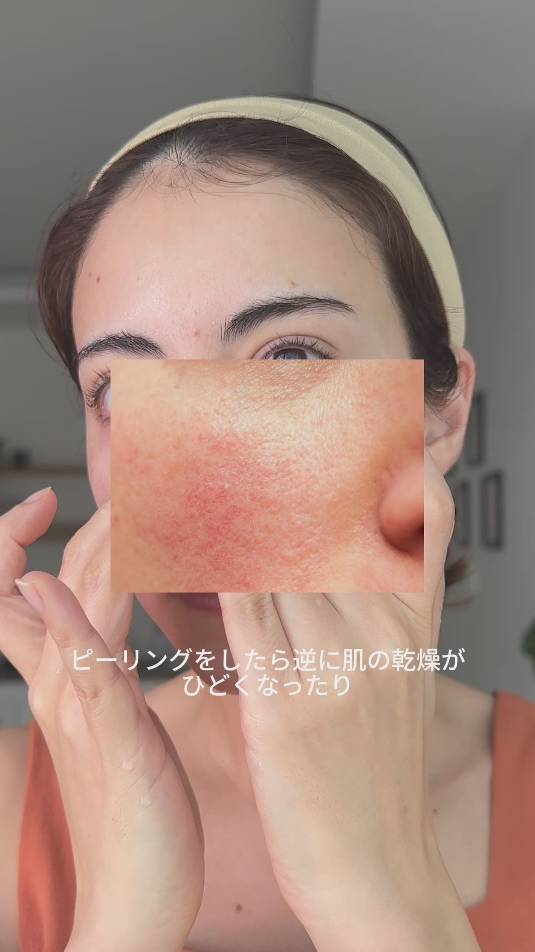 GRATiAE RN フェイシャル ピーリング ジェル 50mL
